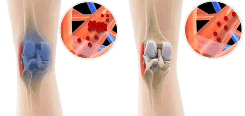 Natural Knee & Joint Pain Relief Patches – Mugwort Herbal Therapy for Long-Lasting Comfort (10PCS)